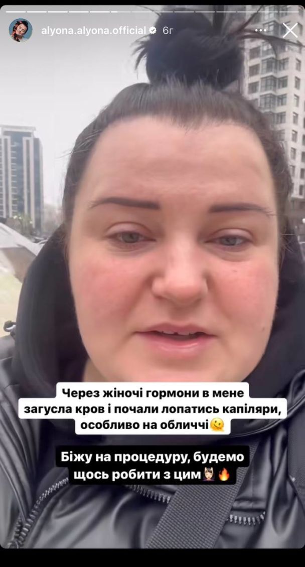 «Просто якась напасть»: учасниця «Євробачення» від України розповіла, як лікується від недугів перед конкурсом2