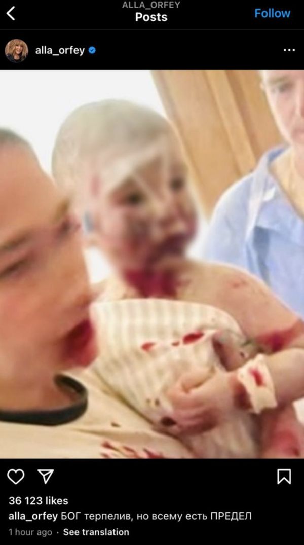 «Бог терплячий, але всьому є межа»: Алла Пугачова засудила обстріл «Охматдиту»1