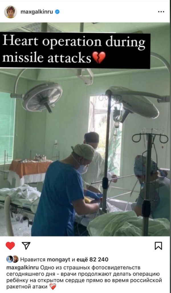 «Бог терплячий, але всьому є межа»: Алла Пугачова засудила обстріл «Охматдиту»2