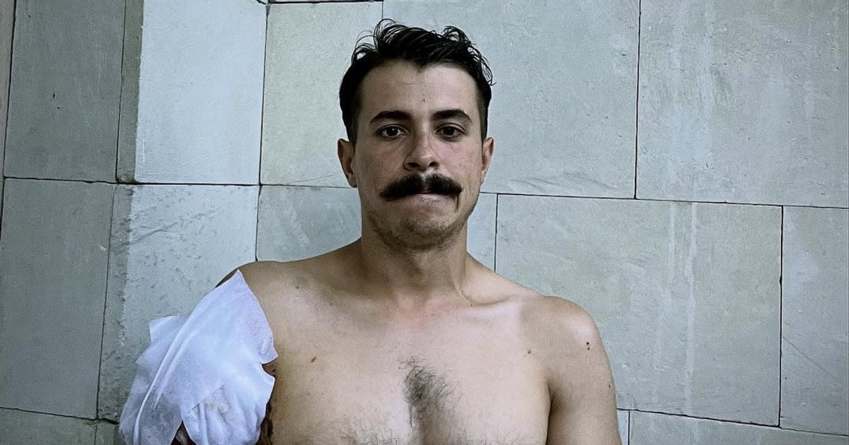 «Мені відірвало руку, але не силу боротися»: зворушлива історія сина Костянтина Грубича, який живе з болем втрати побратимів1