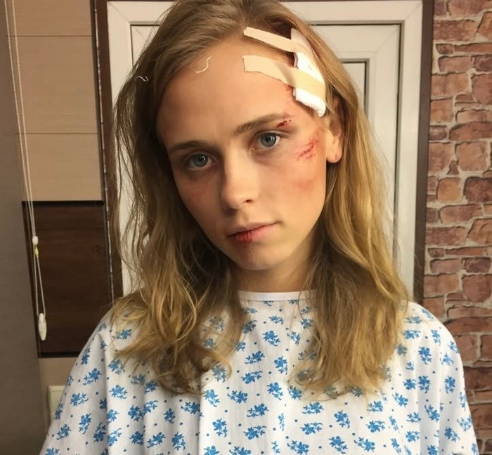 Я вважала себе товстою: зірки діляться своїми світлинами 10-річної давнини4